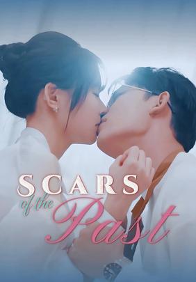 Scars of the Past